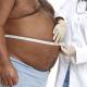 Результаты хирургического лечения метаболических нарушений, связанных с ожирением